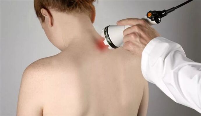 fizjoterapia w leczeniu osteochondrozy szyjnej