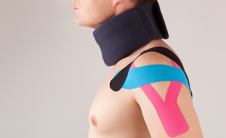 W ostrym okresie osteochondrozy szyjnej należy nosić specjalny kołnierz